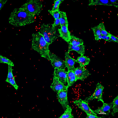 HeLa cervical carcinoma cells incubated with carboxylated polystyrene beads (red).