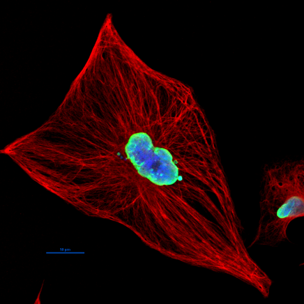 U373 MG astrocytoma cells stained by immunufluorescence