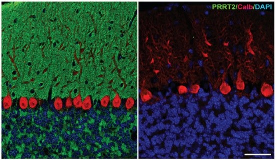 Movement and Neurodegenerative Disorders