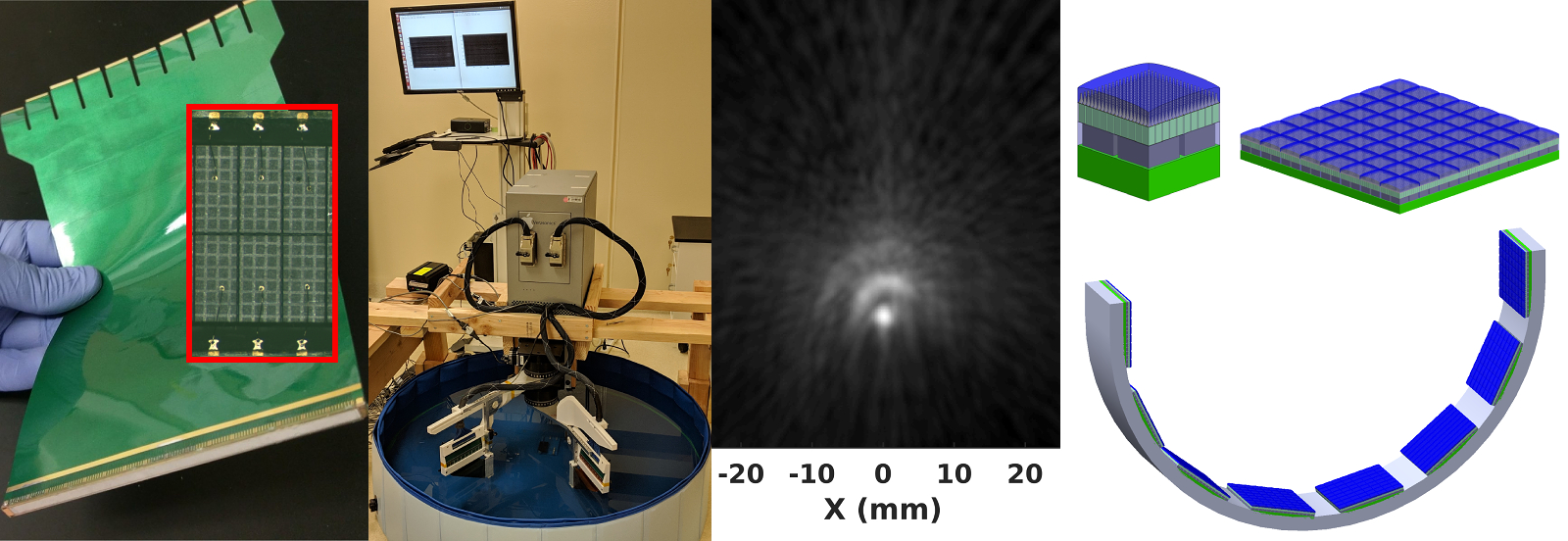 Ultrasound Body Scanner Project